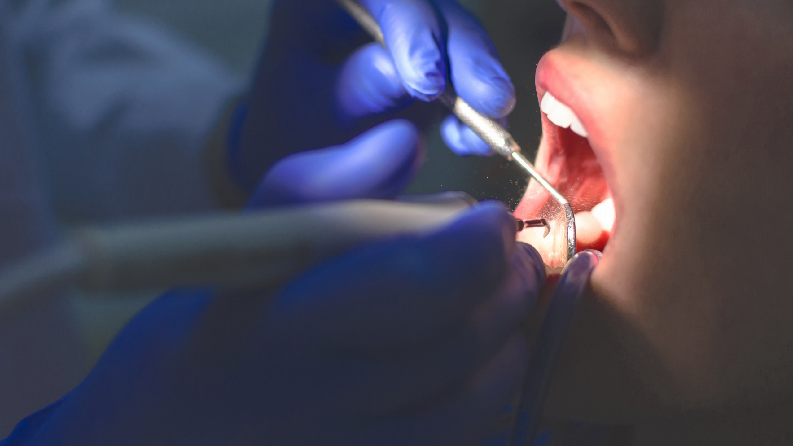 Dentophobie : comprendre et surmonter la peur du dentiste à l’âge adulte